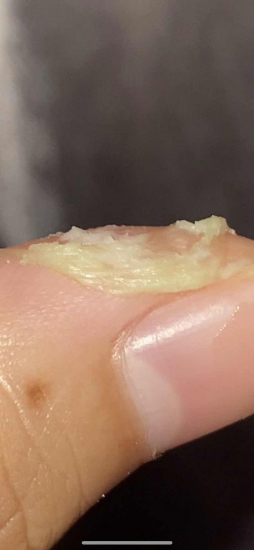 WARNING!! KEPUTIHAN HIJAU