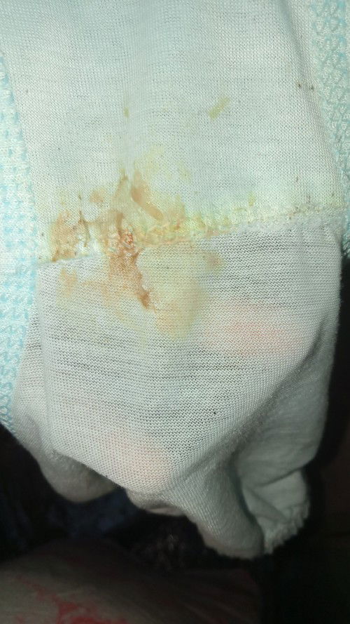 Apakah ini tanda" melahirkan Bun,perut saya kram dan mules,di pinggang panas