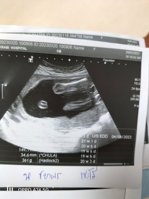 ดูเพศน้องตรงไหนคะ