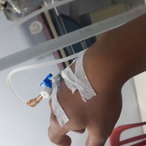 Ketuban pecah duluan