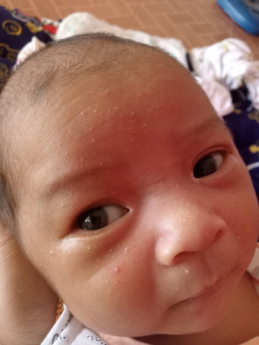แบบนี้น้องเป็นอะไรไหมคะ