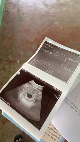 10w ซาวไม่เจอตัวผิดปกติไหม