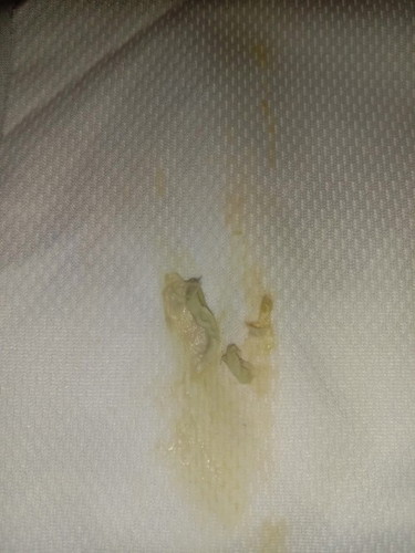 Asking color of discharge