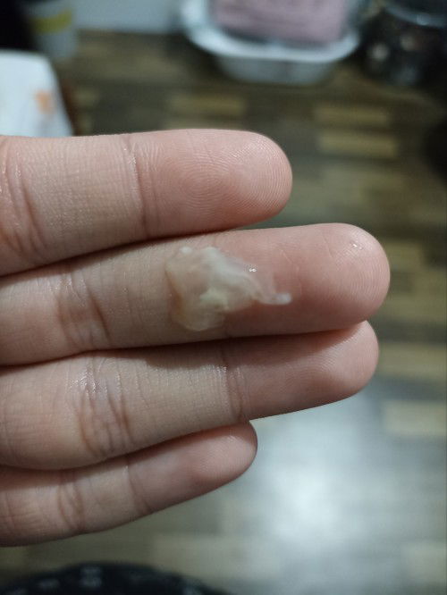 Pregnant 39 weeks 3 hari