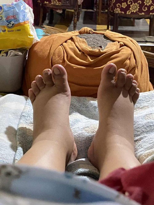 Kaki bengkak setelah melahirkan