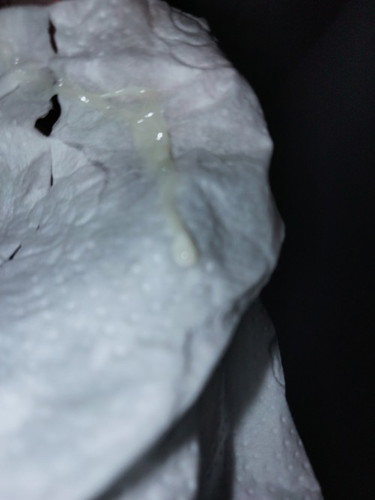 Discharge at 32 weeks