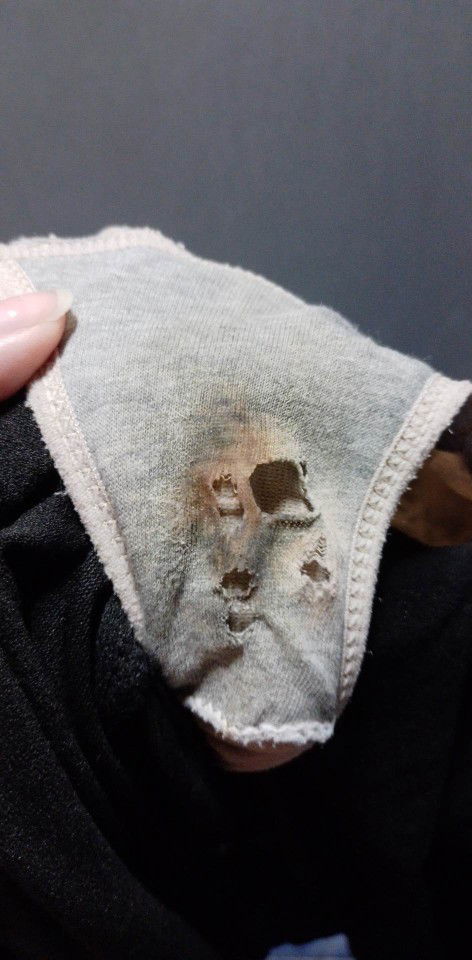 35วีคมีเลือดออก อันตรายไหม