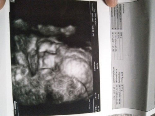 ท้องแรก😄😄