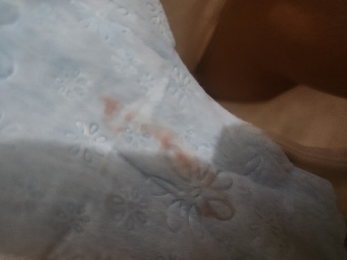 Bun mw nanyak...sya dh priksa hamil 7 mnggu...coba untk puasa...tpi kok sprtinya ngflek.