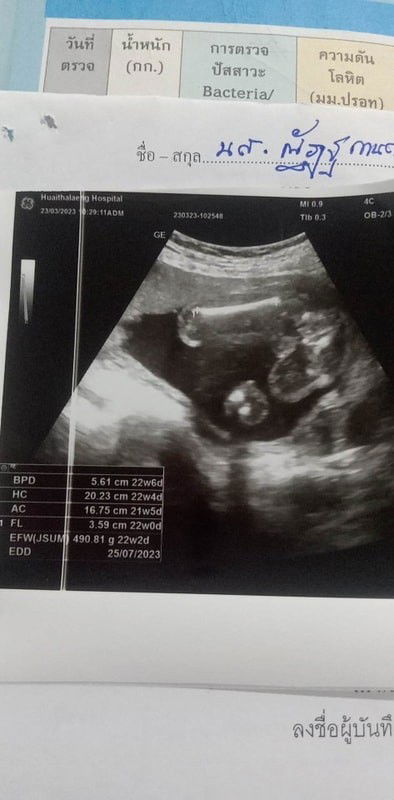 สงสัยกำหนดคลอด