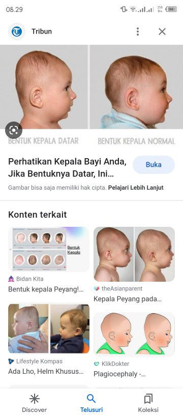 Kepala bayi