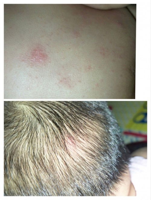 Obat biang keringat bayi 4 bulan