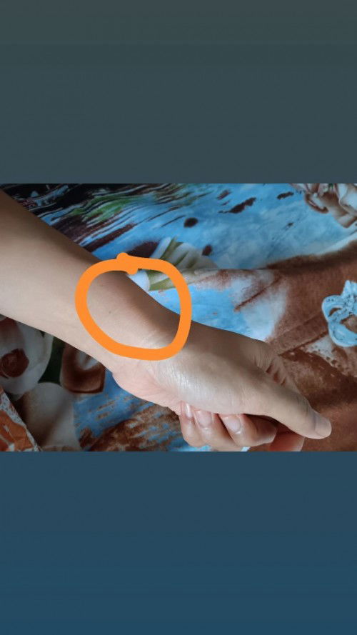 Pergelangan tangan sakit