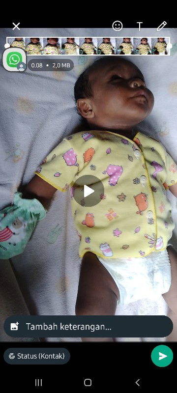 Kemampuan motorik .
Sdh bisa mengerakan tangan dan kaki