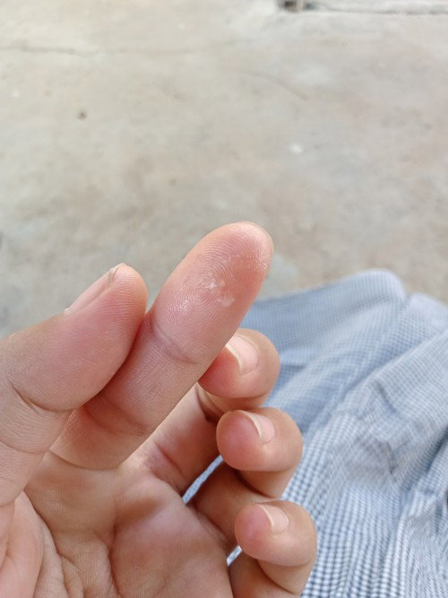 มีมูกใสเหนียวๆ