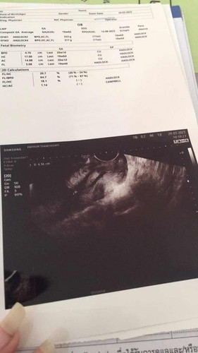 🎀👶🏻ท้องแรกจ้า👶🏻🎀 แม่😻