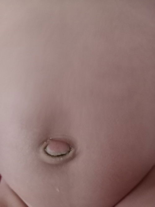 Pusar bayi 2 bulan merah dan menonjol