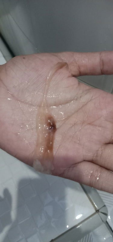 Keluar flek di usia 17w6d apakah wajar Bun?