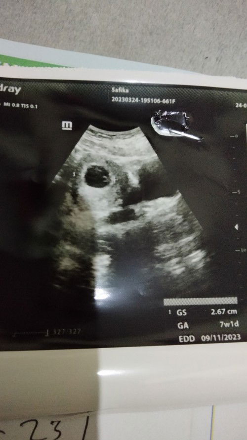 Usg 7w1d Masih kantung saja