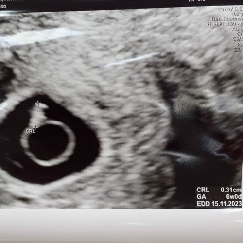 ICIS นับครรภ์ และตั้งวันคลอดในApp นี้อย่างไร