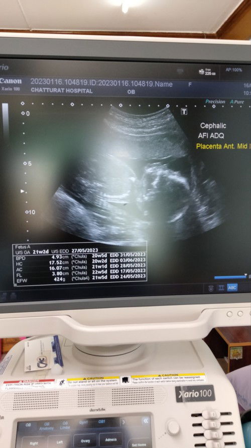 ตั้งชื่อจริงลูก?