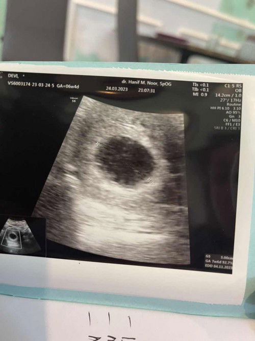 Hamil 6 minggu 4 d