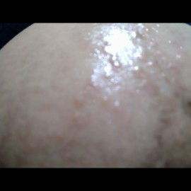 Strecmack wrna merah mudah dan gatal