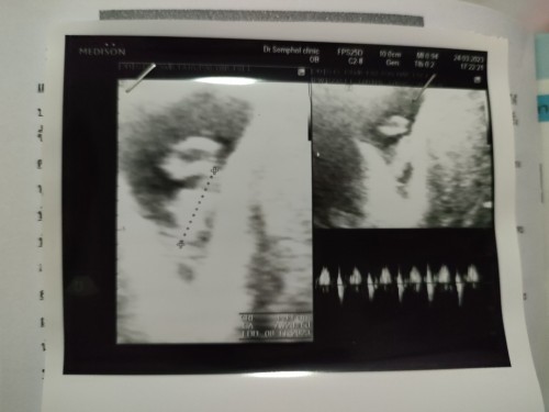 8week1day เจ้าหนูของแม่