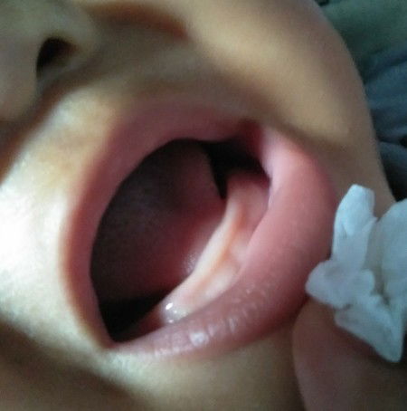 Apakah ini mau tumbuh gigi?