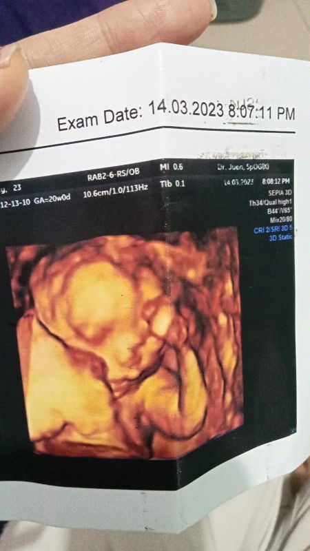 Kehamilan 21 Minggu ngerasain apa aj sekarang Bun ? Boleh sharing