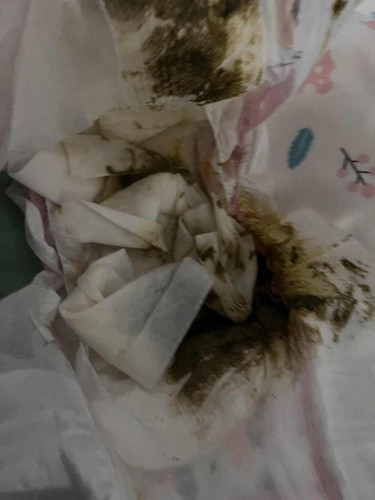 Pasintabi po sa poop na pic