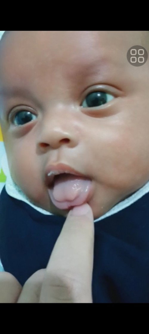 Anak gak mau menjukurkan lidah