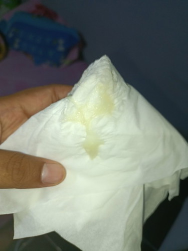 มันคืออะไรค่ะแม่ๆ