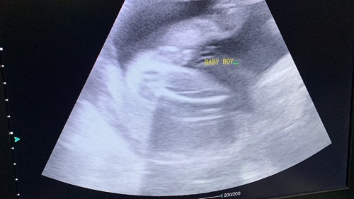 BABY BOY?