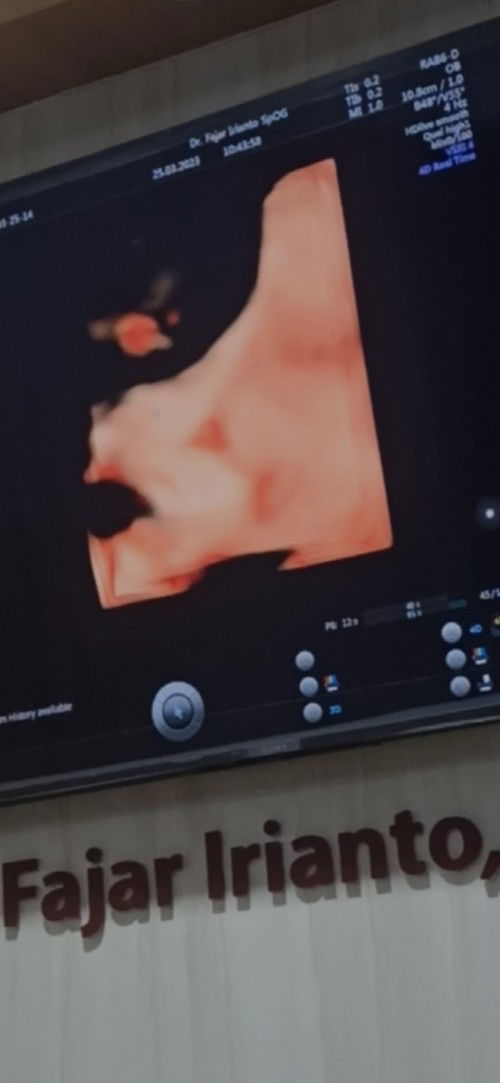 USG bikin overthinking