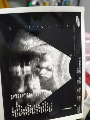ท้องได้30วีค น้ำหนักลูกน้อยไปไหมคะ
