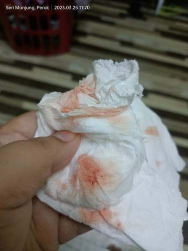 Ini darah spotting atau haid??