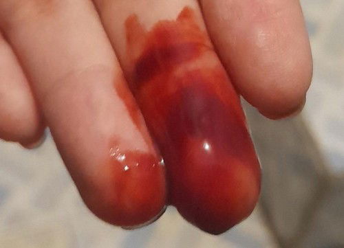 Bun ada yang tau gak ini darah implantasi atau haid ya??saya sedang program kehamilan haid saya aja