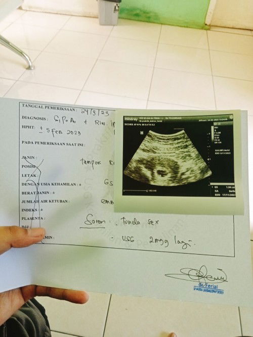 6week masih terlihat kantung janin saja apakah normal?