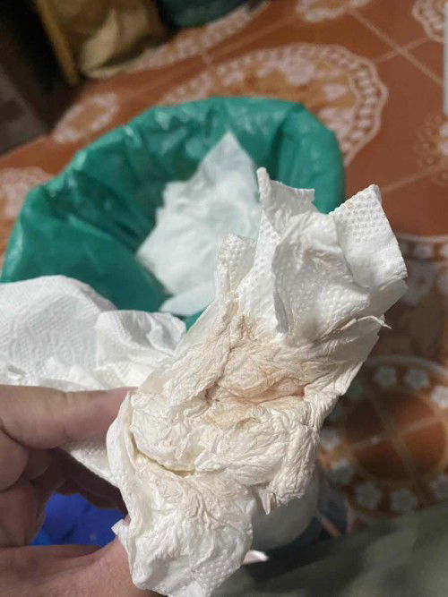 ท้อง39w1d มีเลือดปนสีน้ำตาล ท้องแข็งบ่อนแต่ไม่มีอาการเจ็บท้องเลย ไปหาหมอได้เลยมั้ยคะ