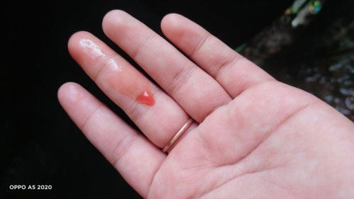 Pipis Bersamaan Dgn Darah