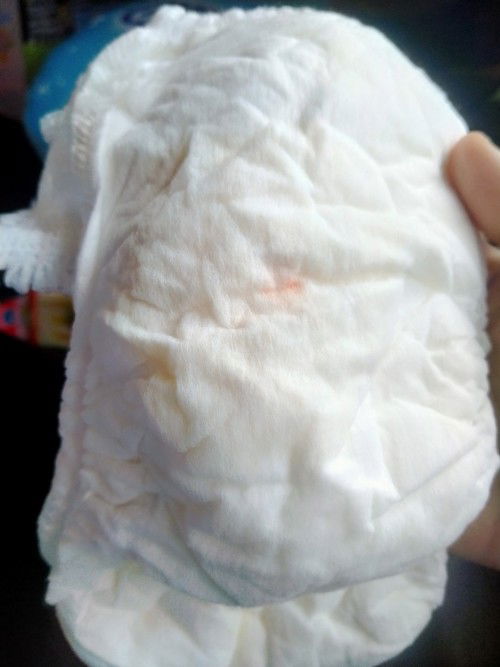 ลูก4เดือน ฉี่สีเหลืองเข้ม มีจุดส้มๆติดอยู่ที่เเพมเพิส