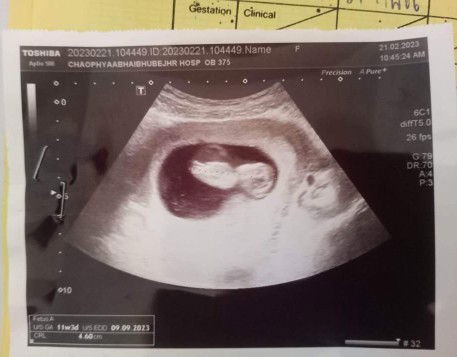 มาอวดใบซาวด์กันค่า