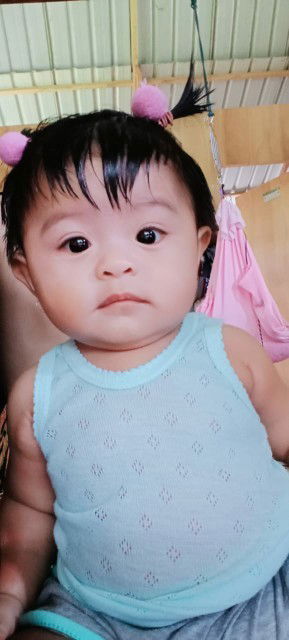 Apakah bayi harus dibotak?