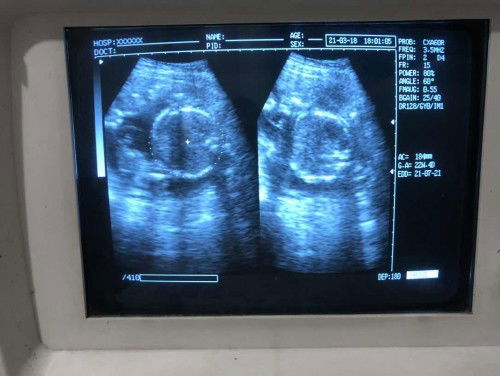 BBJ Janin yang betul