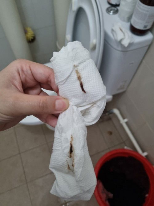 Bleeding during 1st trimester