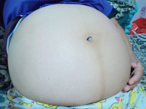 27 week แล้วค่ะ แม่ๆๆบ้านไหนเจอแบบนี้ไหม