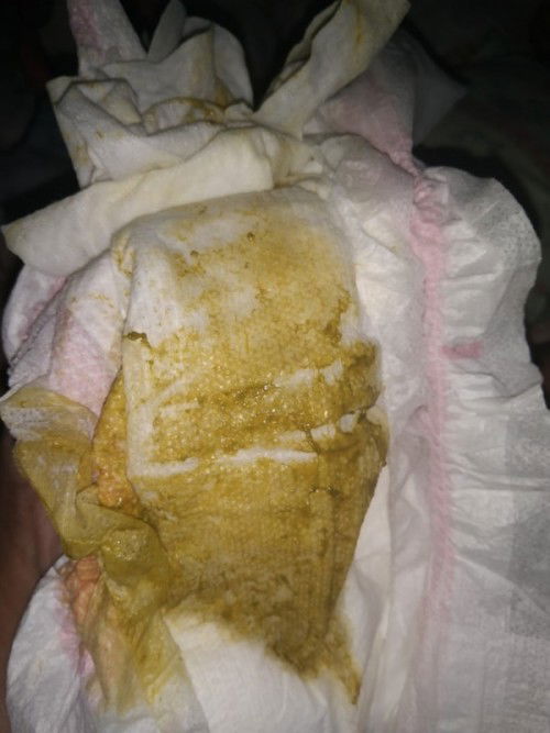 Normal lang ba to? 3 months old na si baby