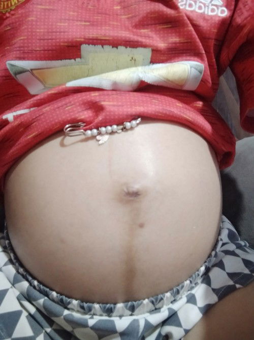 แม่ๆคนไหนเส้นกลางไม่ตรงแบบนี้บ้างคะ