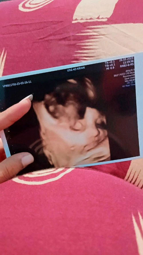 Usg 4D jalan 31 minggu